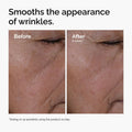 Multi-Peptide + HA Serum