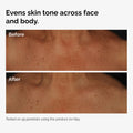 Niacinamide 5% Face and Body Emulsion
