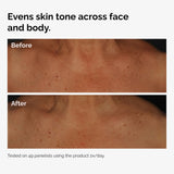 Niacinamide 5% Face and Body Emulsion